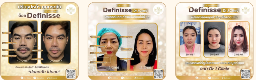 Juvelook หน้าเงาใส